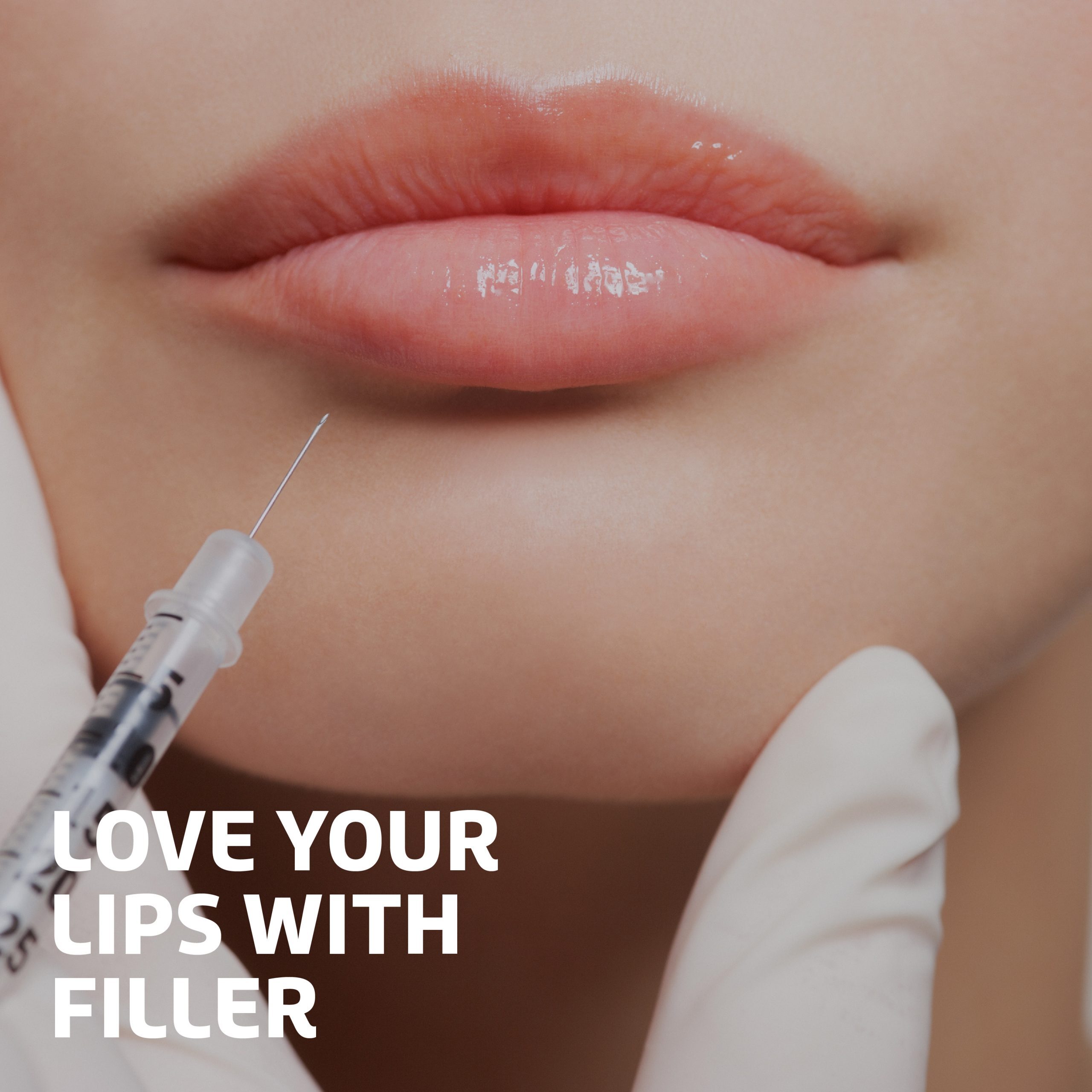 Love Your Lips with Filler Blog